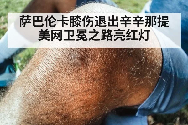 萨巴伦卡膝伤退出辛辛那提 美网卫冕之路亮红灯